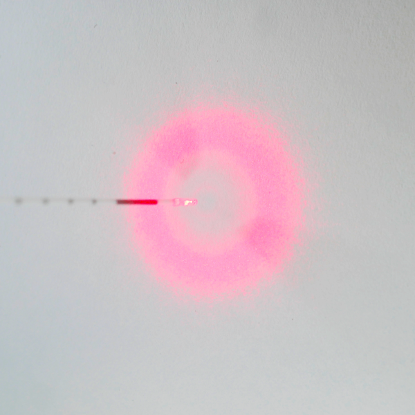 Hémorroïdes laser